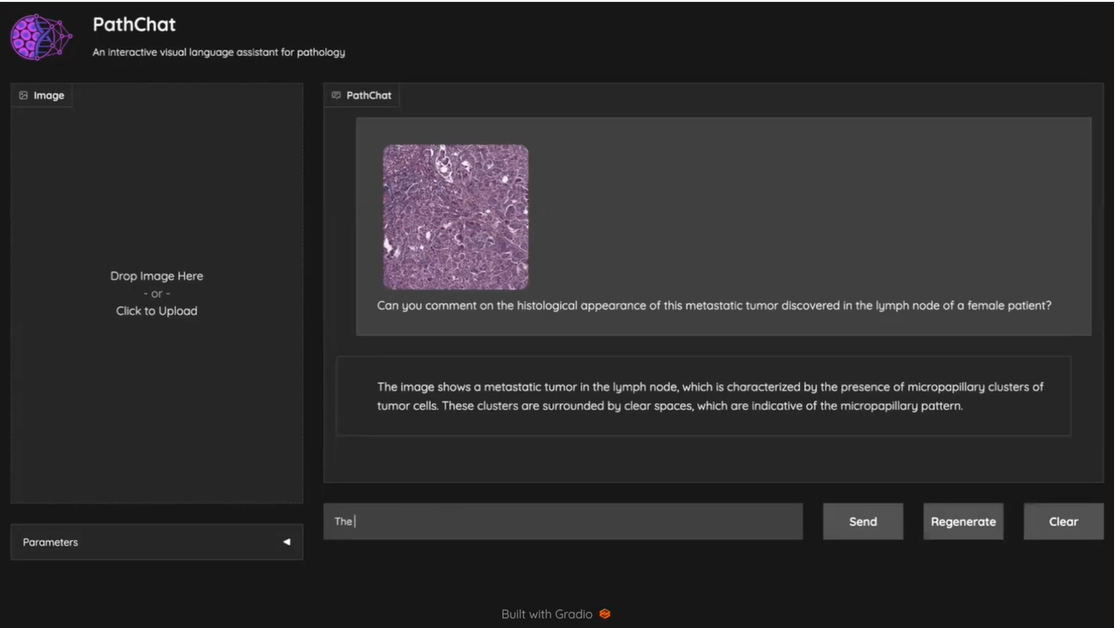 Mahmood Lab releases PathChat, a vision-language AI assistant for Pathology